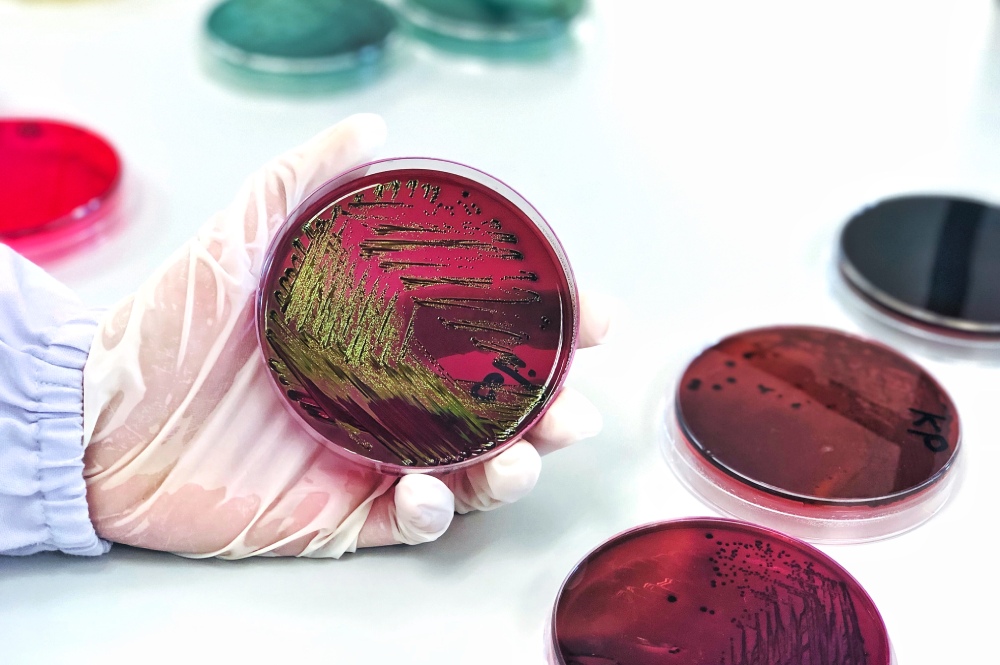 Understanding chromogenic culture media 