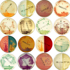 BioMérieux SA - Microbiology - Chromogenic culture media