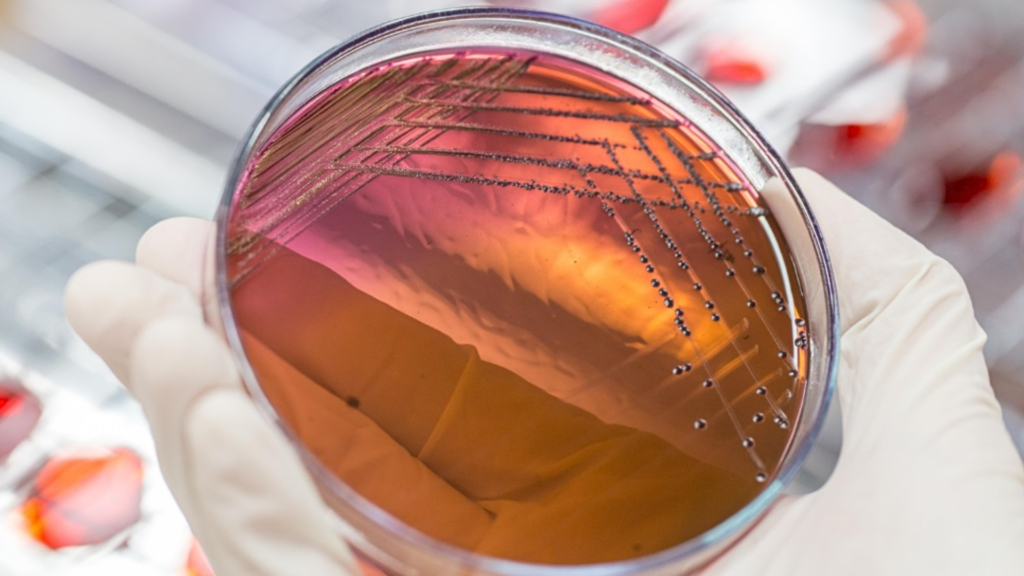 Antimicrobial Effectiveness Test for Non-sterile Pharmaceutical Aqueous Products